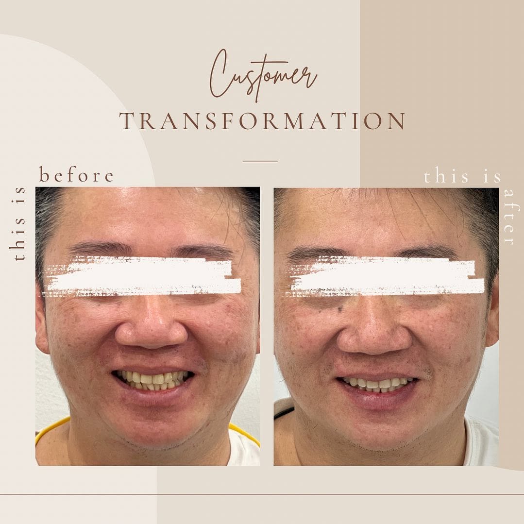 before after delight dental 3