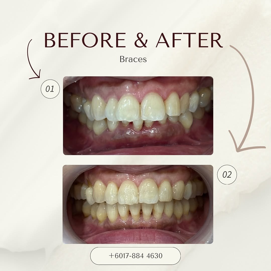 before after delight dental 4