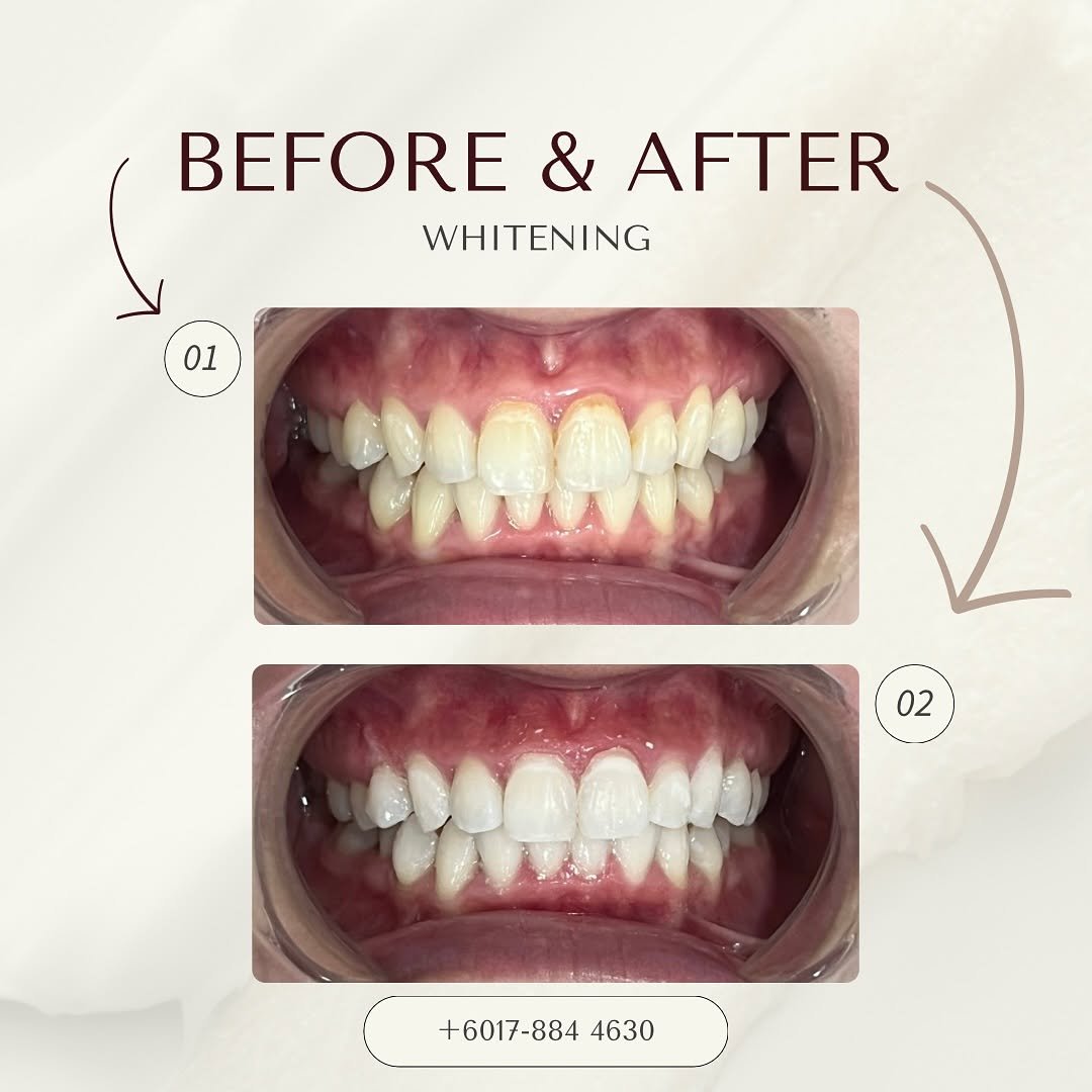 before after delight dental 5