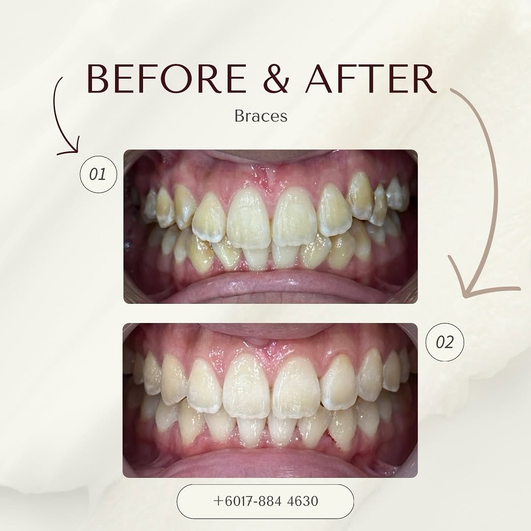 before after delight dental
