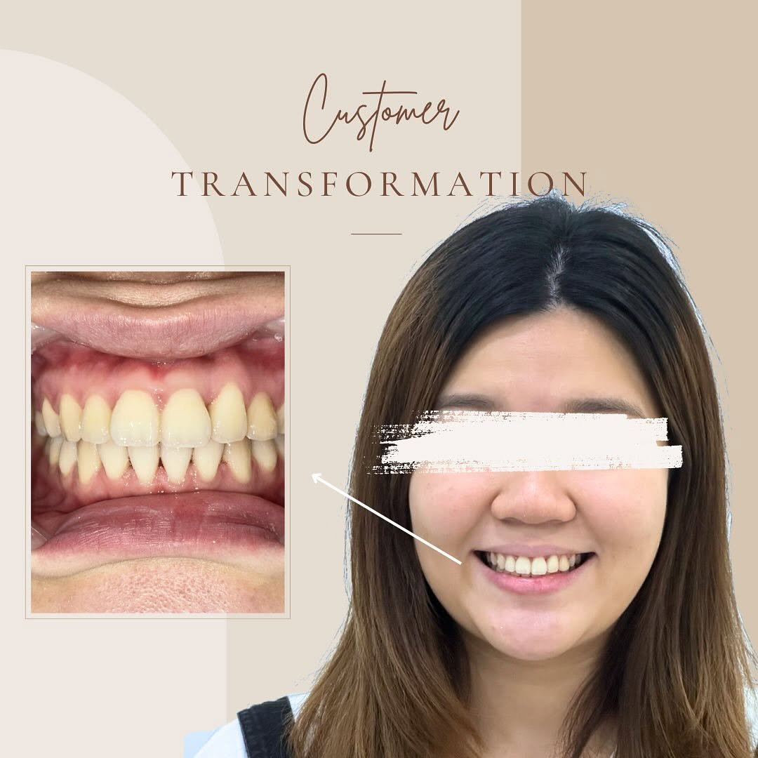 customer transformation delight dental4