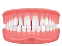 Excessive Spacing dental illustration