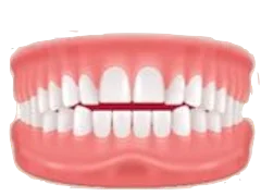 Open Bite dental illustration