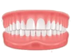 Overbite dental illustration