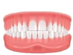 Underbite dental illustration